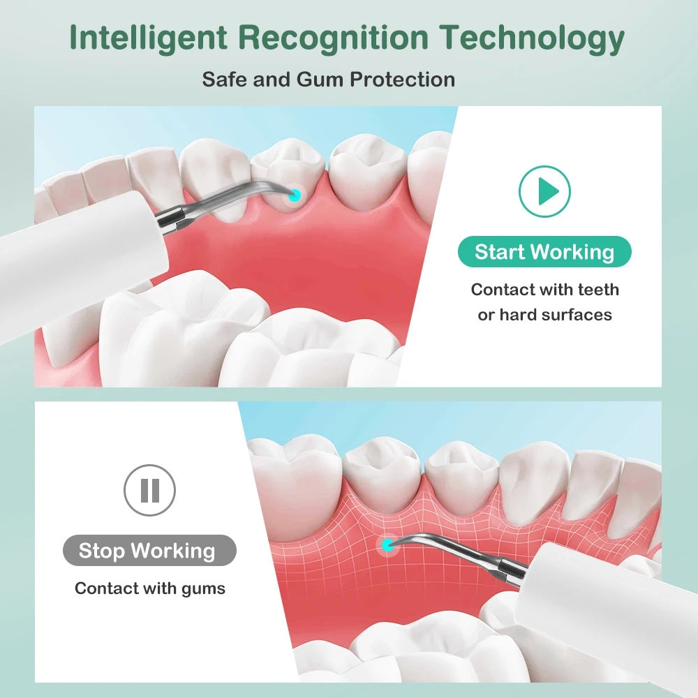 PearlPik Ultrasonic Plaque Remover Kit