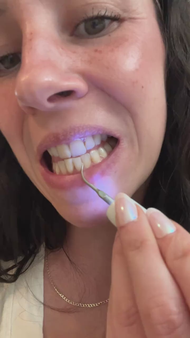 PearlPik pen used on the front teeth with the tip light on
